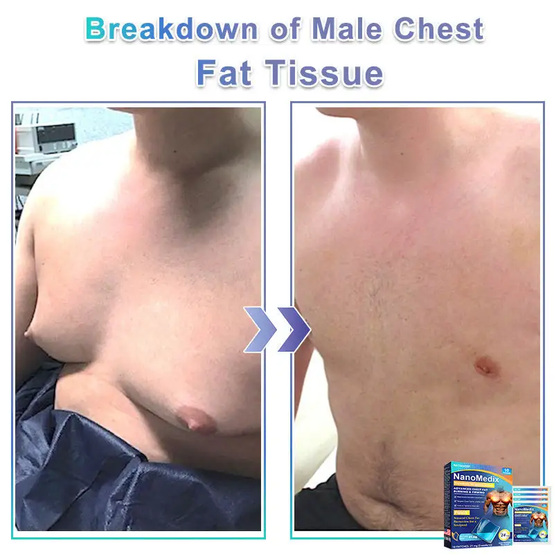 NanoMedix Gynecomastia Chest Fatburn & Firm Patch - Image 3