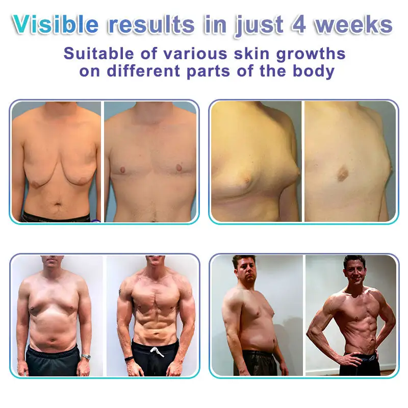 NanoMedix Gynecomastia Chest Fatburn & Firm Patch - Image 4