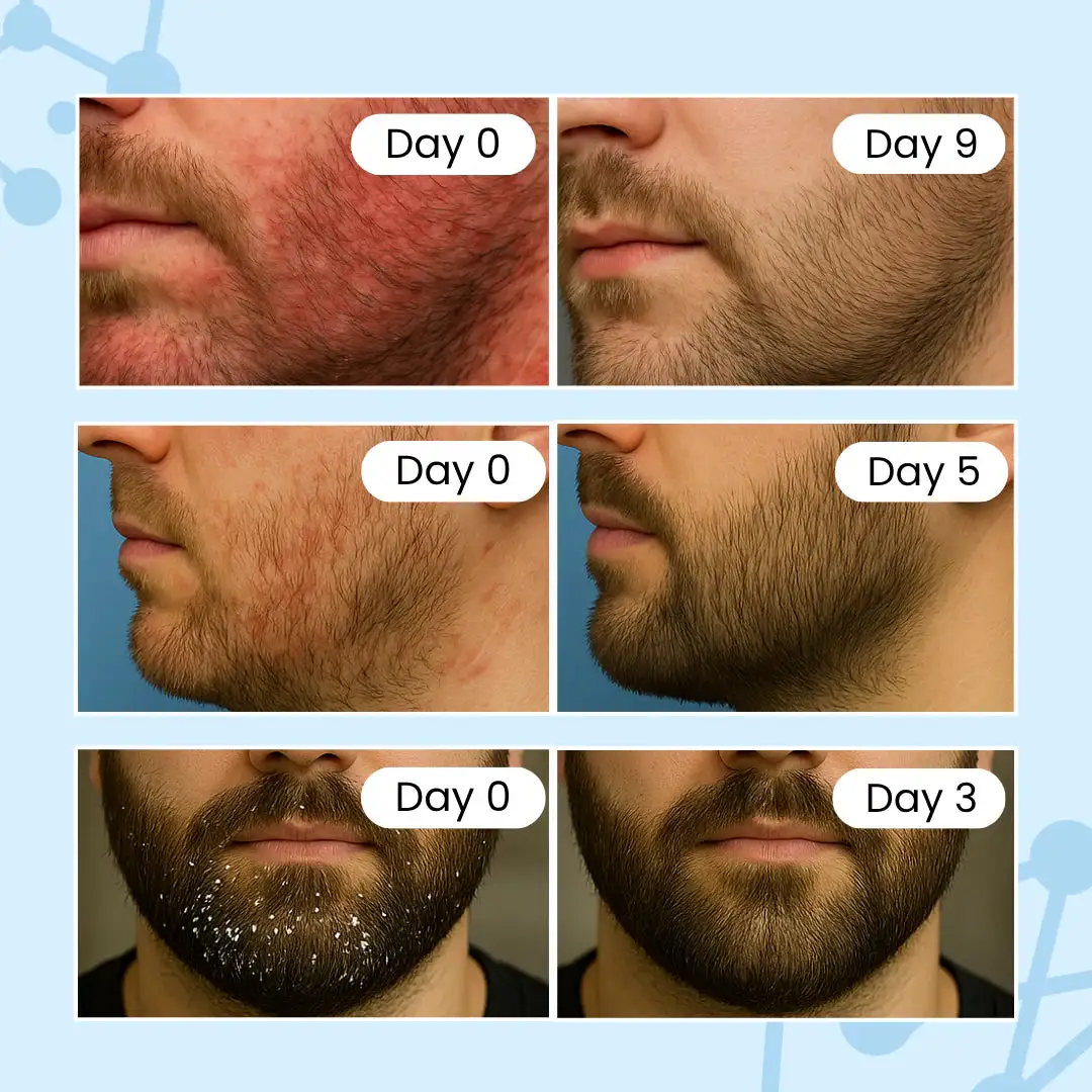 Beard Relief Balm - Image 10
