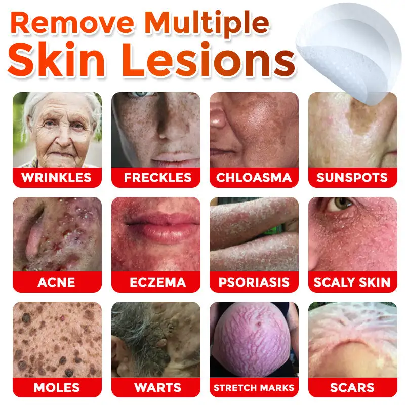 MicroNeedle Botanic Skin Tag Removal Patch - Image 3