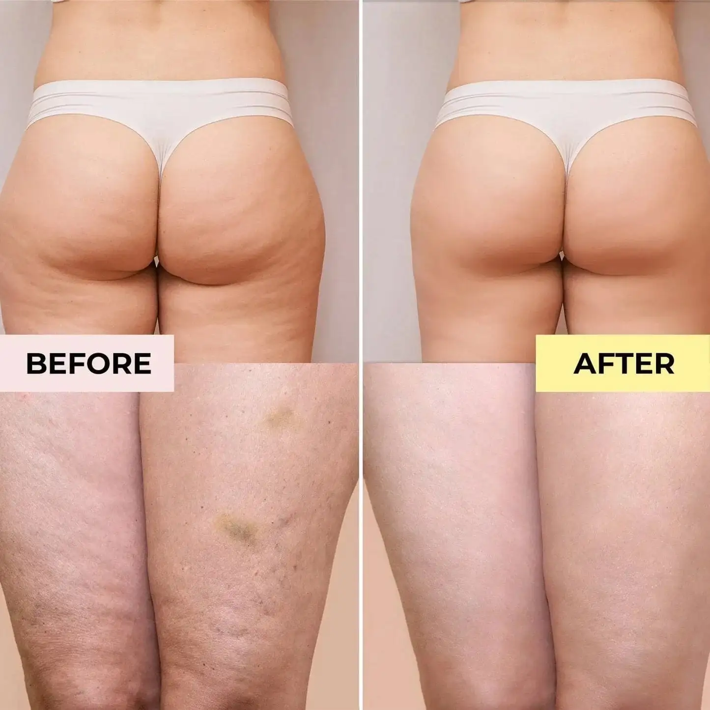 Slimoly Anti Cellulite Massage Oil - Skin Tightening Moisturizing - Image 10