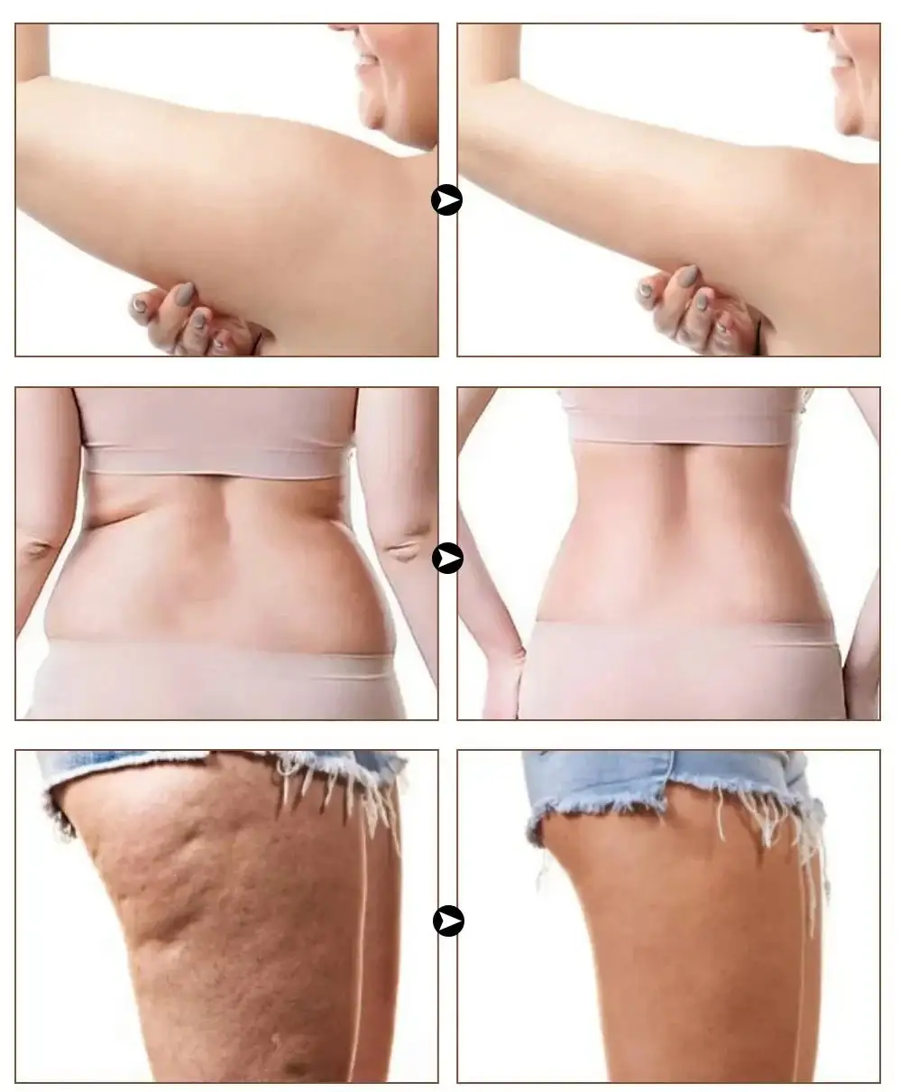 Slimoly Anti Cellulite Massage Oil - Skin Tightening Moisturizing - Image 9