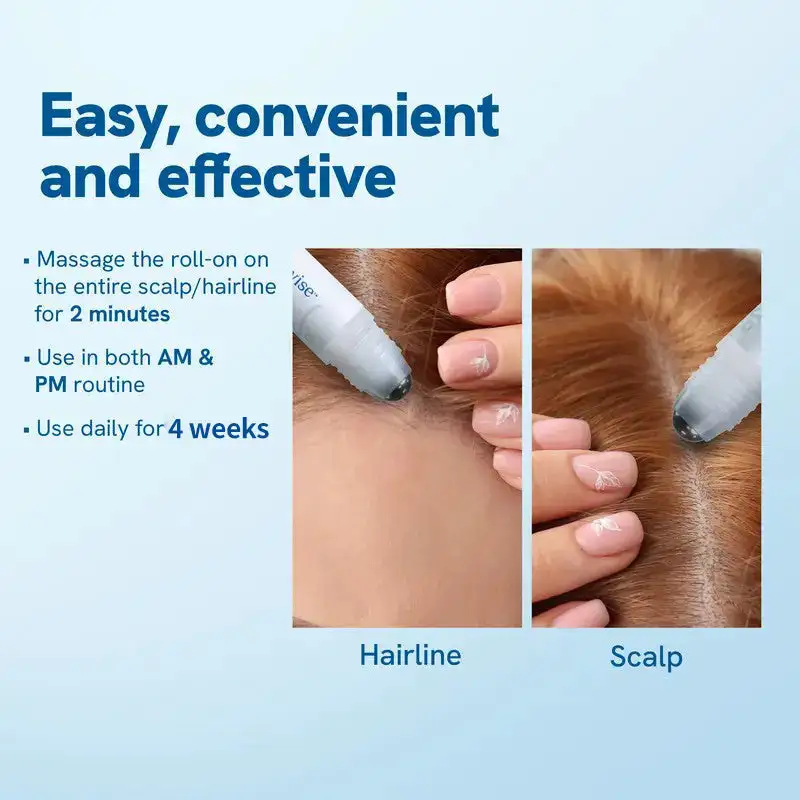 Anti-Hair Loss Roll-On – Stop Shedding & Boost Growth - Image 3