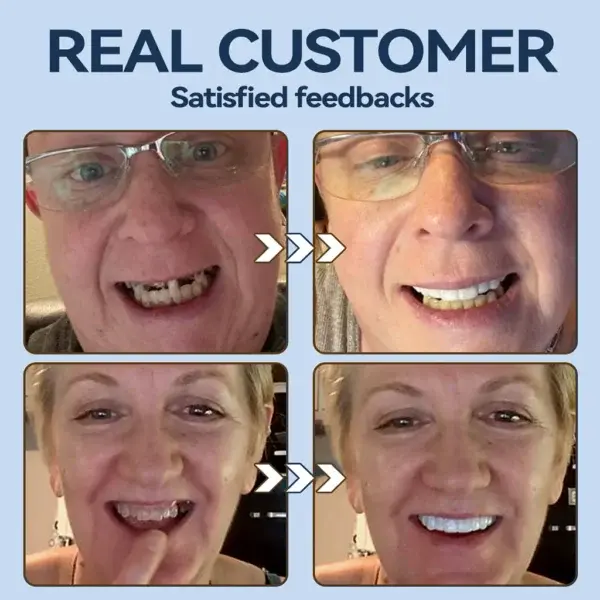 – MedicalFit Adaptive Dentures – Suitable for all mouth shapes perfect fit - Image 10