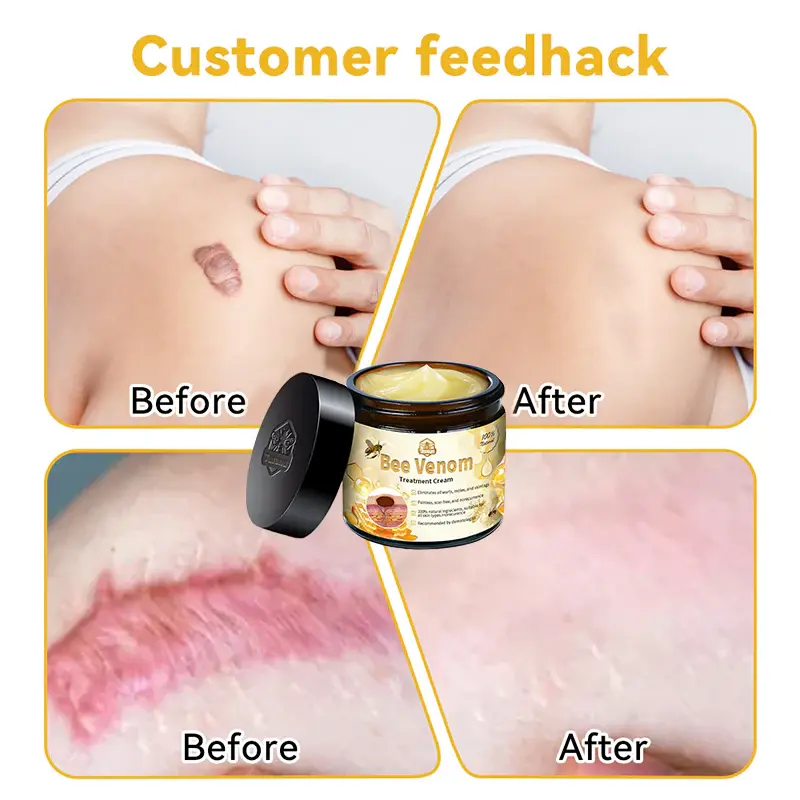Bee Venom Multi-Action Skin Repair Cream - Image 8
