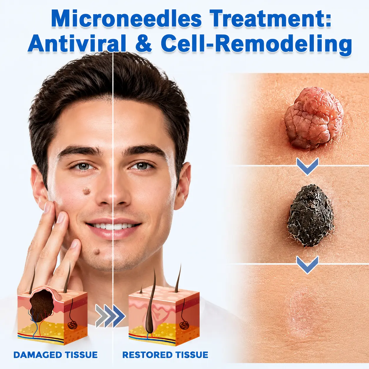 2-in-1 Microneedle & Hydrocolloid Patch - Image 10