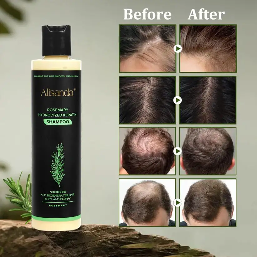 Organic Rosemary Hair Growth Shampoo - Image 4