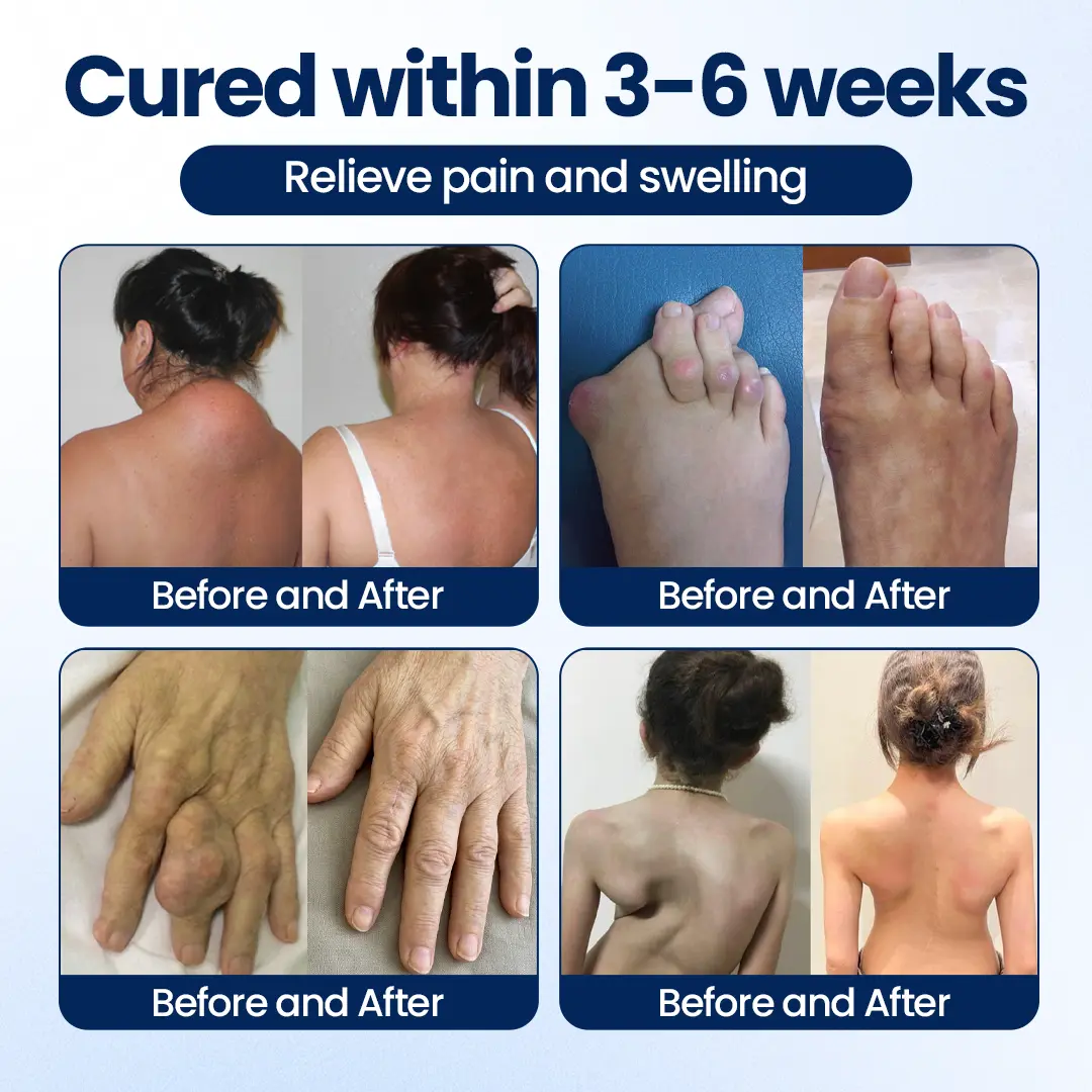 ArthriNAD+ Pro Advanced Joint Recovery Cream - Image 7