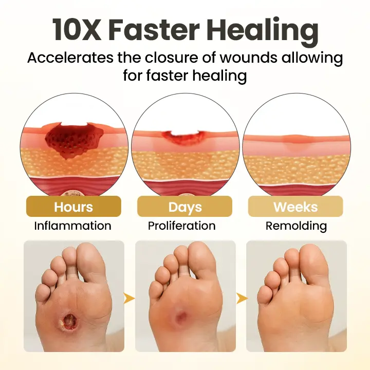GlucaVeil: 24H Anti-Friction Foot Armor - Image 11