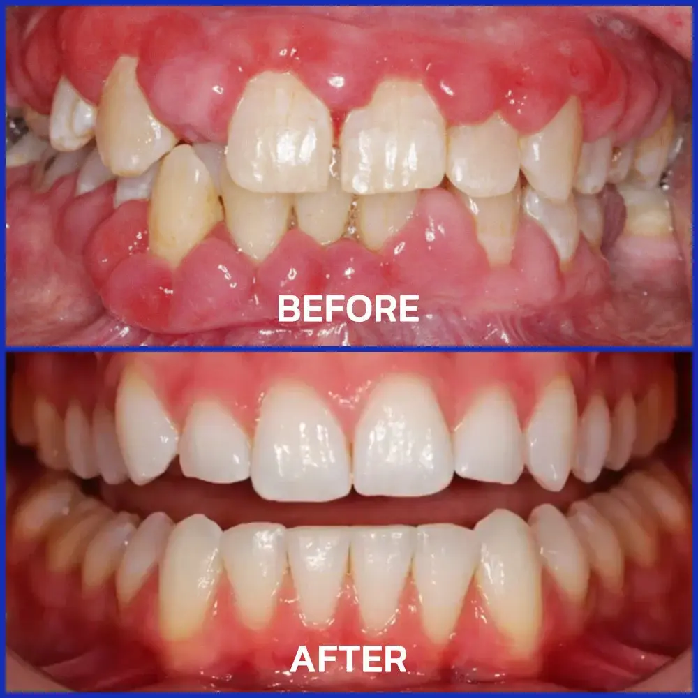 VioCore Bee Venom Dental Treatment Toothpaste - Image 2