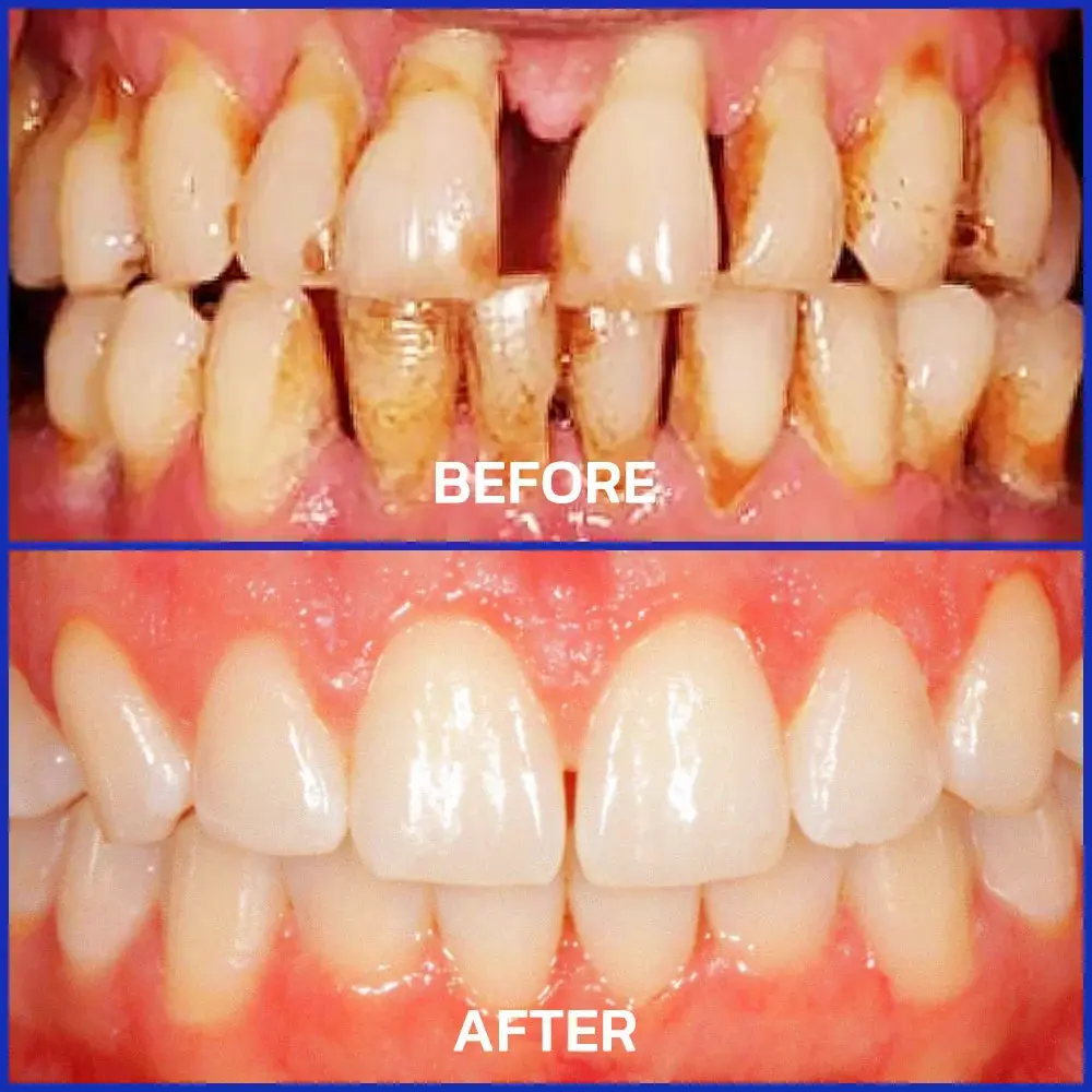 VioCore Bee Venom Dental Treatment Toothpaste - Image 3