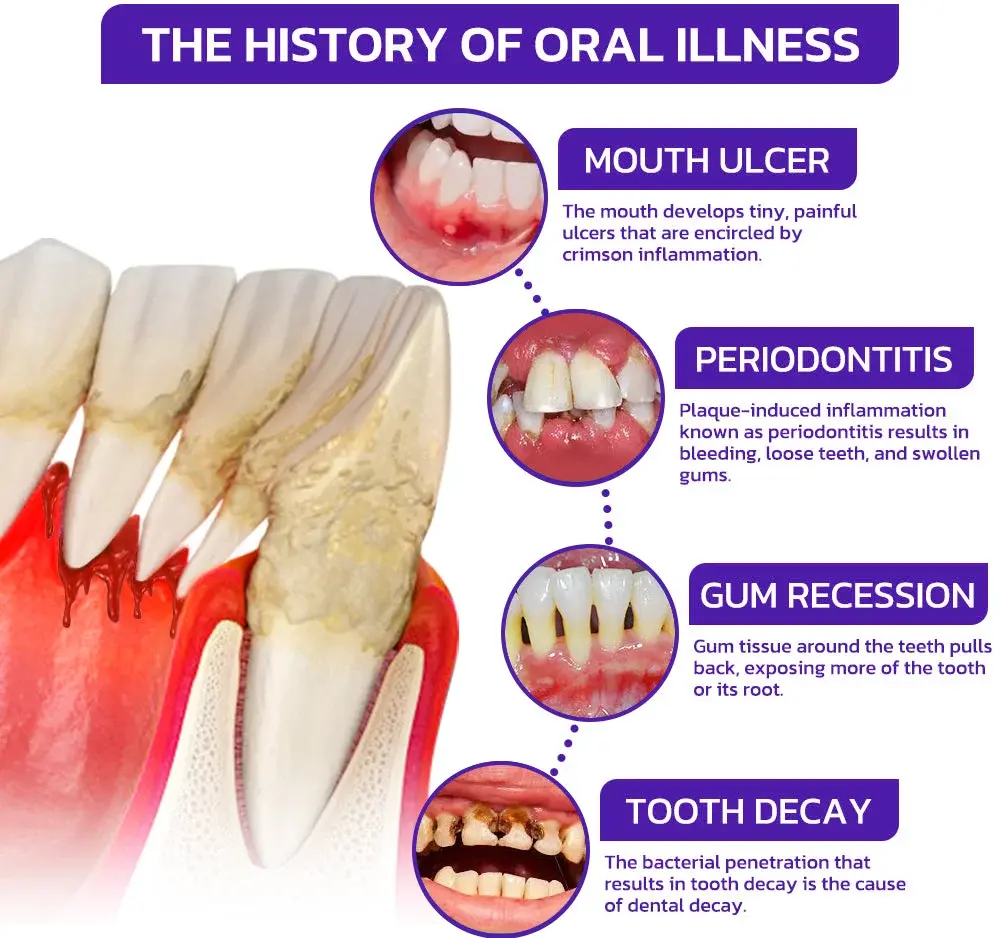 VioCore Bee Venom Dental Treatment Toothpaste - Image 5