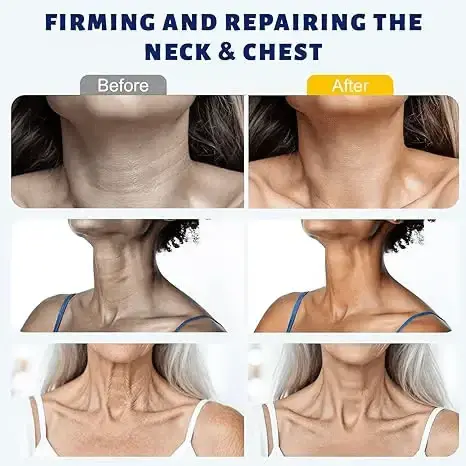 5-Ball Roller Neck Firming Cream with Retinol & Hyaluronic Acid - Image 6