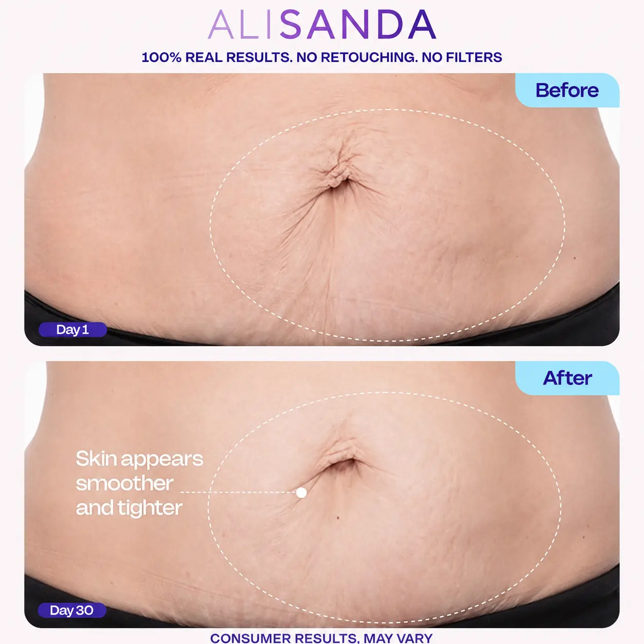 ALISANDA Tighten & Smooth Belly Cream - Image 6