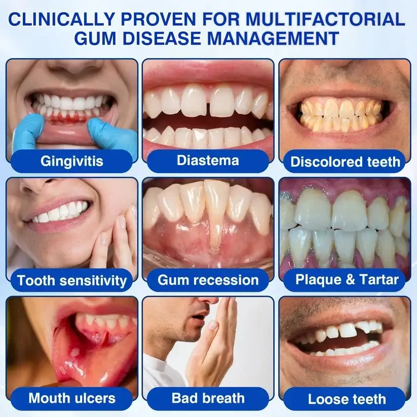 GumRevive Periodontal Repair Gel - Image 10