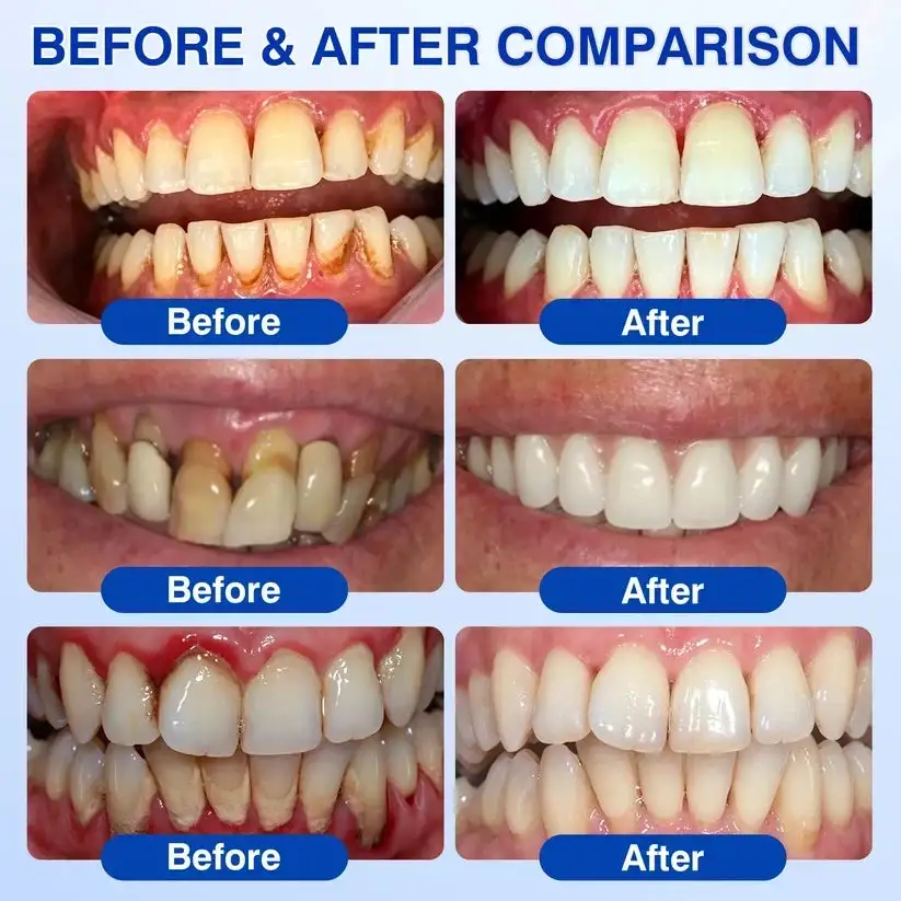 GumRevive Periodontal Repair Gel - Image 5