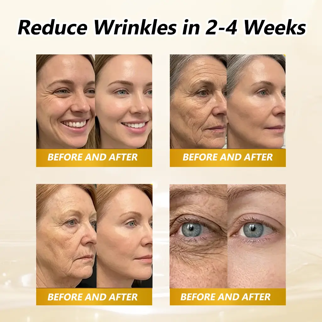 BEE VENOM BIO-REVIVE BODY ROLLER - Image 2