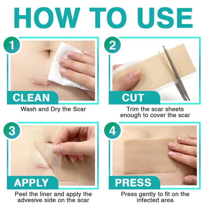 3-in-1 Scar Removal Microneedle Care Patch - Image 12