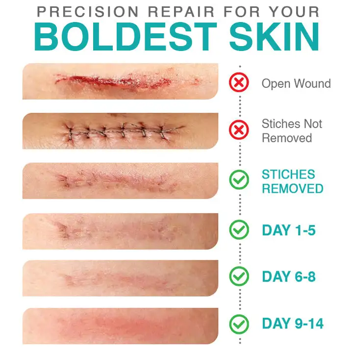 3-in-1 Scar Removal Microneedle Care Patch - Image 7