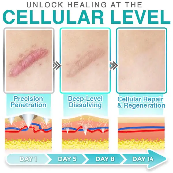 3-in-1 Scar Removal Microneedle Care Patch - Image 9