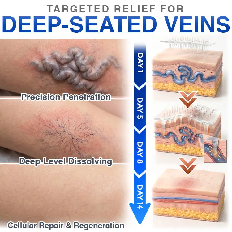 Varicose Veins Treatment Microneedle Patch - Image 5