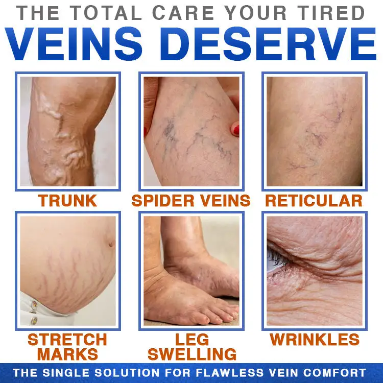 Varicose Veins Treatment Microneedle Patch - Image 6