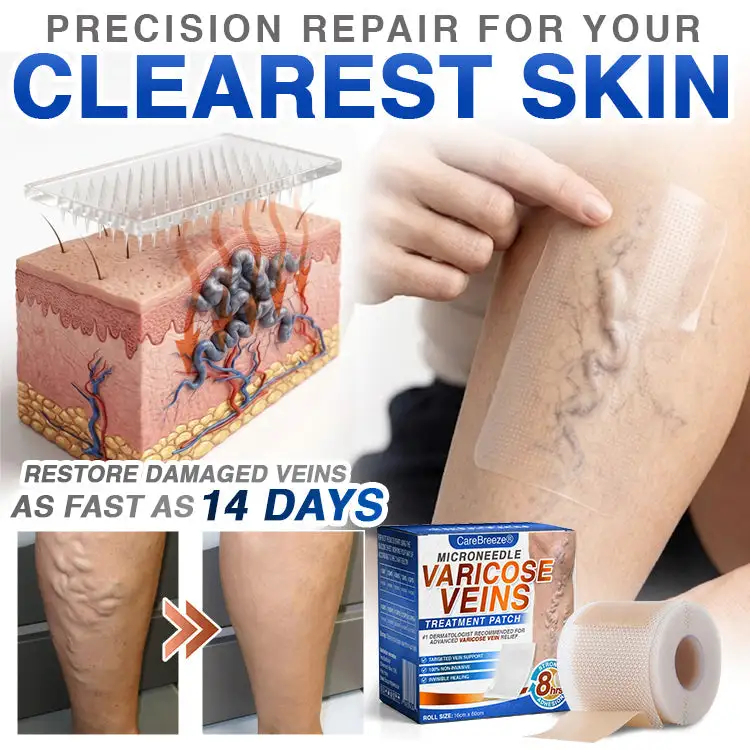 Varicose Veins Treatment Microneedle Patch - Image 9