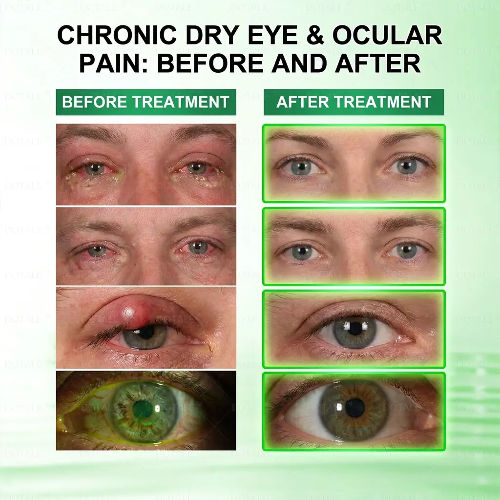 Presbyopia Mask - Image 7