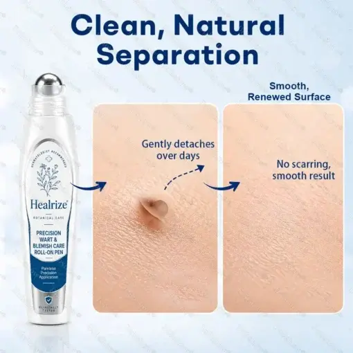 7-Day Blemish Remover Pain-Free & Scar-Free Advanced Roller Pen for Skin Tags and Spots - Image 6