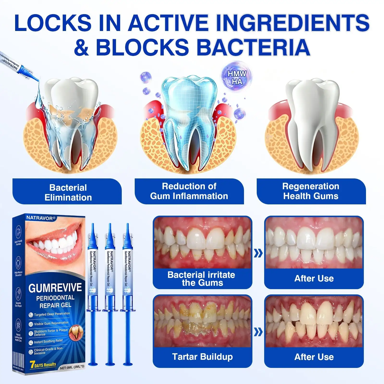 GumRevive Periodontal Repair Gel - Image 8