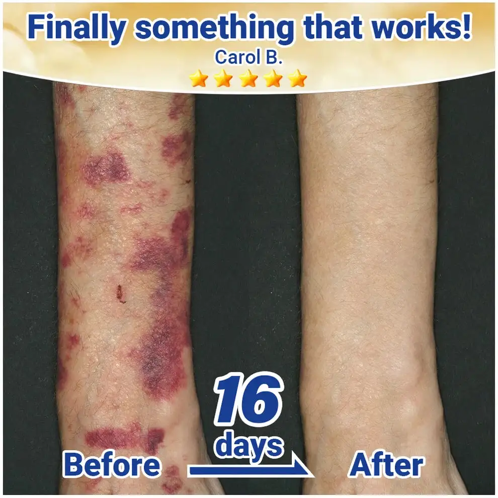 ResiliVeil Bruise Appearance Barrier Care Cream - Image 3