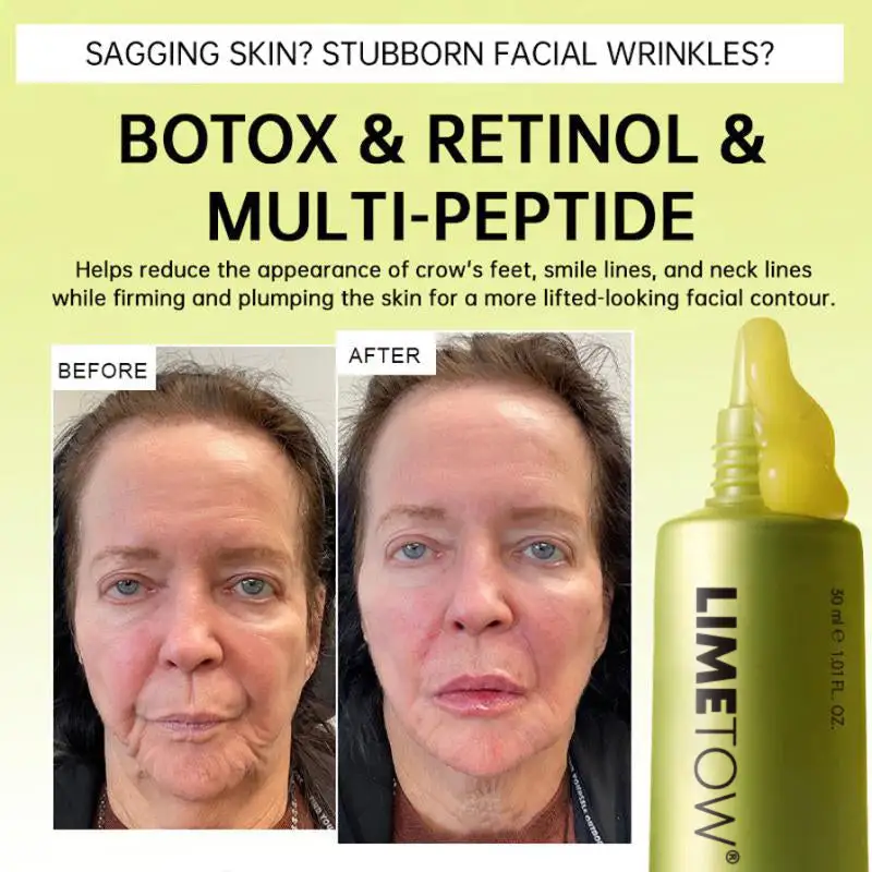 Multi-Peptide Retinol Shot Wrinkle-Lift Cream - Image 6