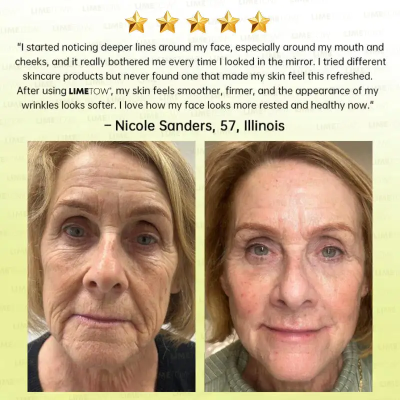 Multi-Peptide Retinol Shot Wrinkle-Lift Cream - Image 7