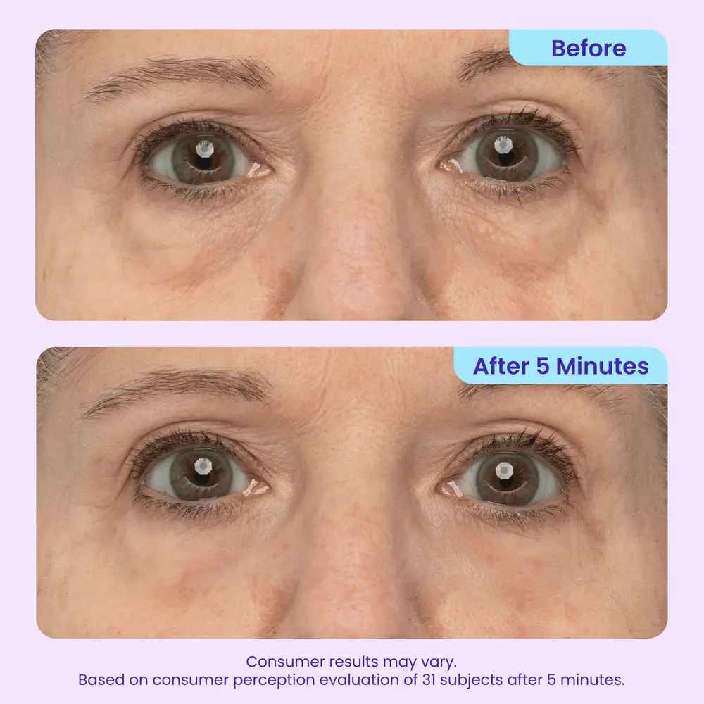LOVILDS Instant Lift Eye Gel - Image 5