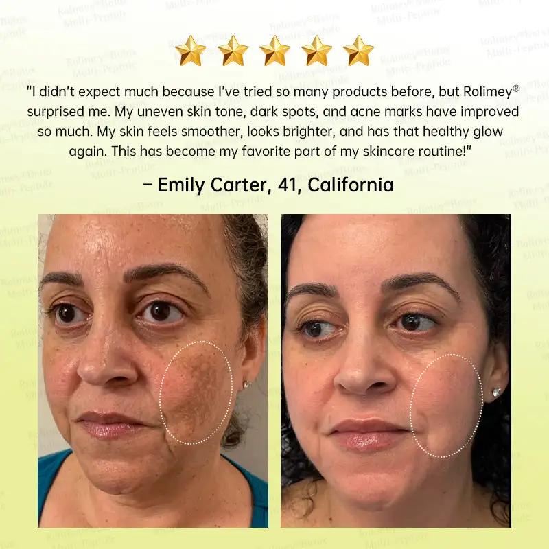 Botox & Multi-Peptide Retinol Shot Wrinkle-Lift Tightening Cream - Image 7