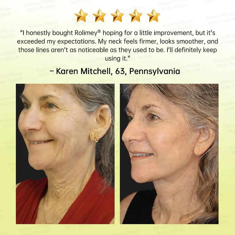 Botox & Multi-Peptide Retinol Shot Wrinkle-Lift Tightening Cream - Image 9