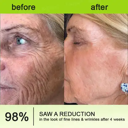 Botox & Vita-A Retinol Shot Wrinkle-Lift Tightening Cream - Image 11