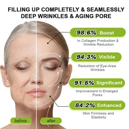 Botox & Vita-A Retinol Shot Wrinkle-Lift Tightening Cream - Image 15