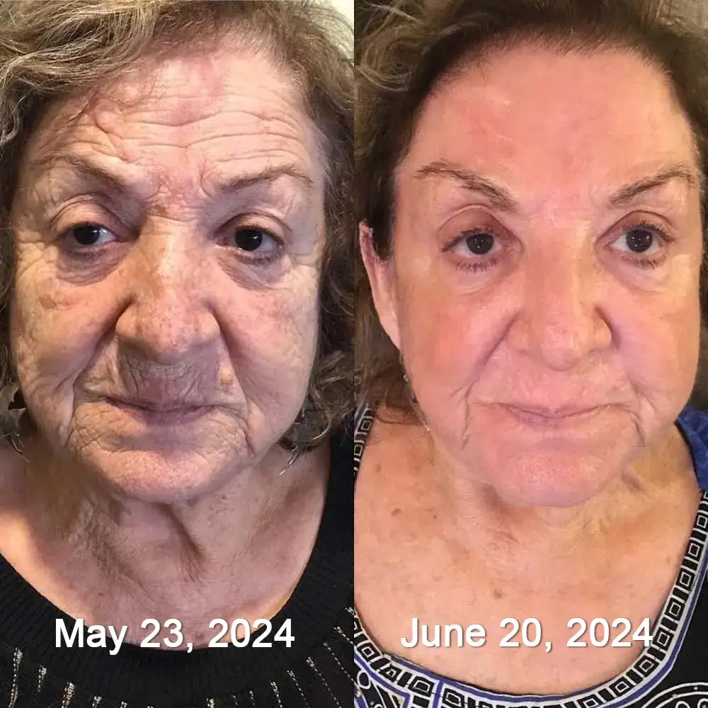 Botox & Vita-A Retinol Shot Wrinkle-Lift Tightening Cream - Image 2