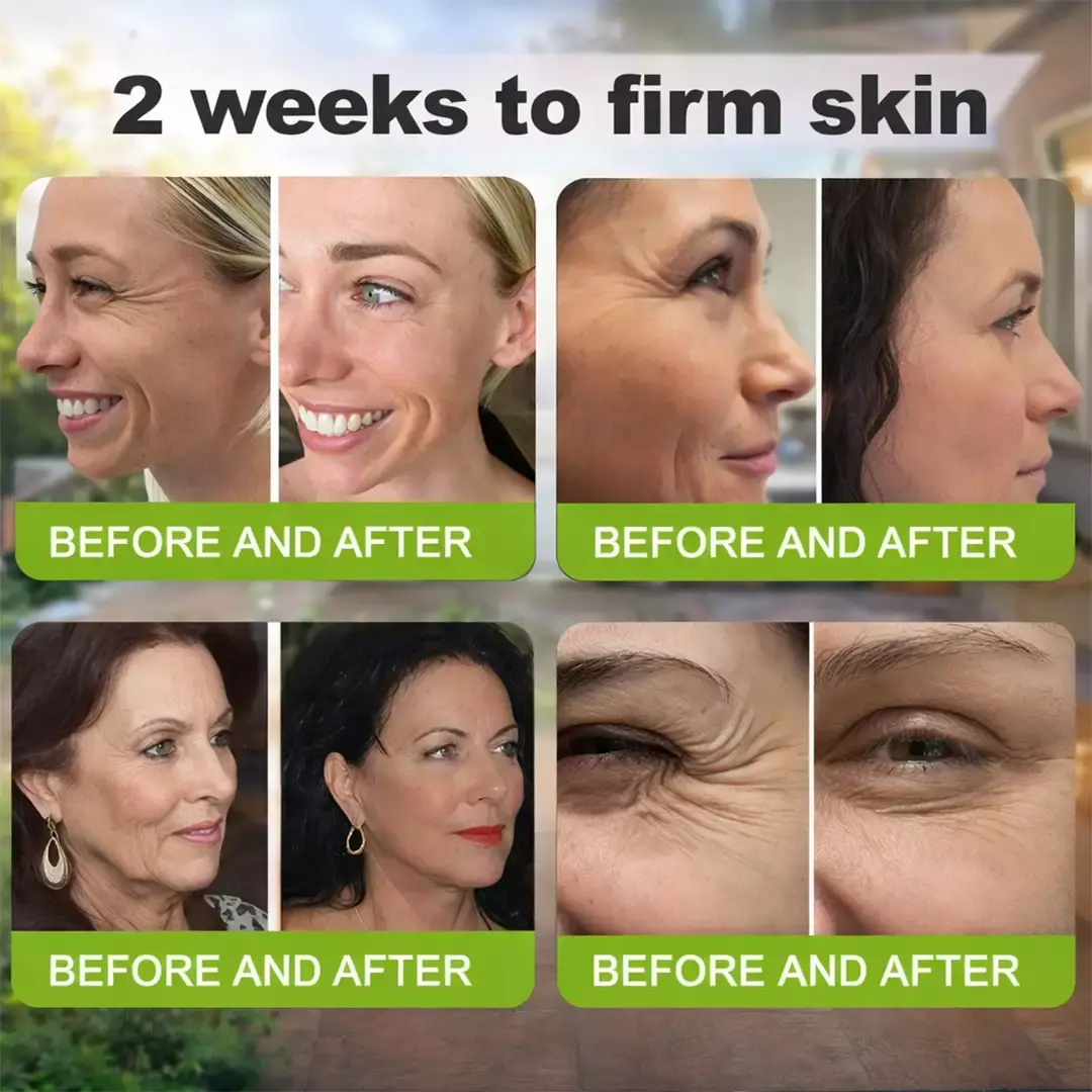 Botox & Vita-A Retinol Shot Wrinkle-Lift Tightening Cream - Image 6