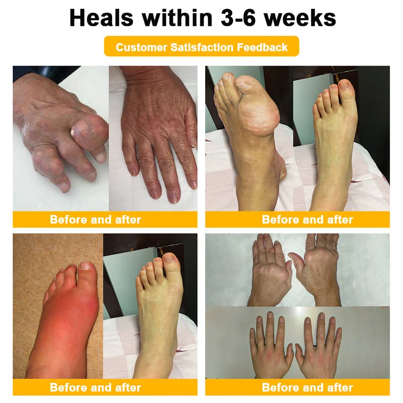 Botulinum Toxin & Bee Venom Joint Pain Relief - Image 5