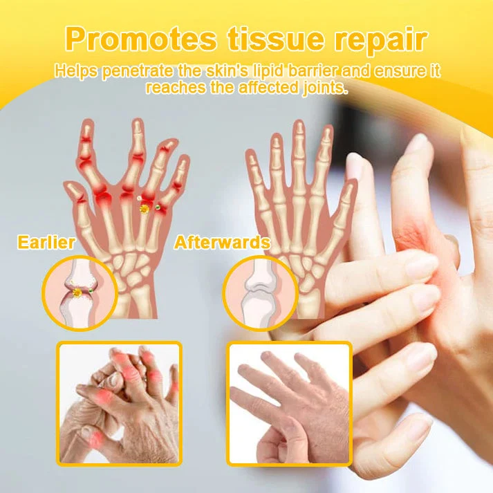 Botulinum Toxin & Bee Venom Joint Pain Relief - Image 2