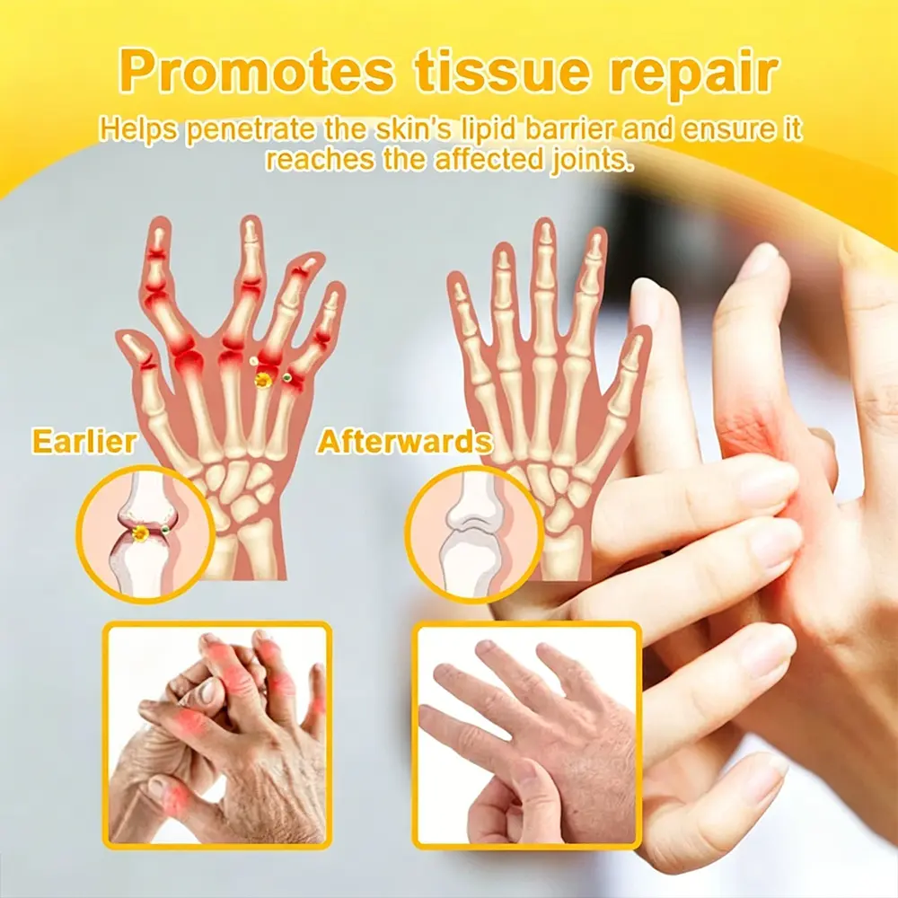 Joint Pain Relief Patches - Image 14