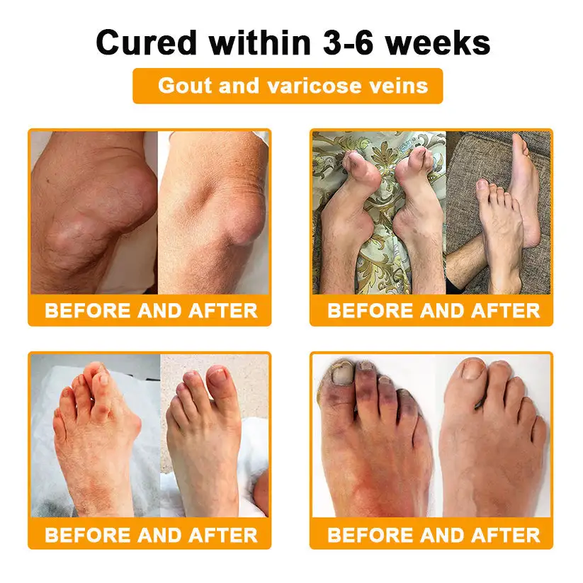 Joint Pain Relief Patches - Image 3