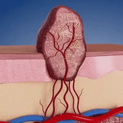 Blemish Clear Microneedle Patches - Image 2