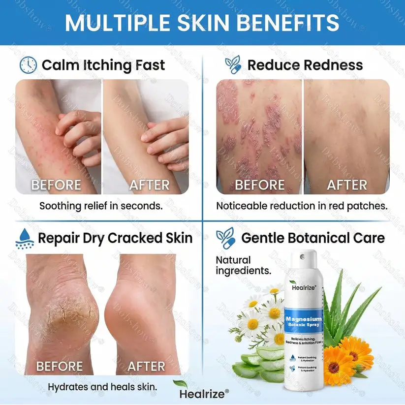 Magnesium Botanic Spray – Advanced Skin Recovery for Psoriasis & Eczema - Image 10