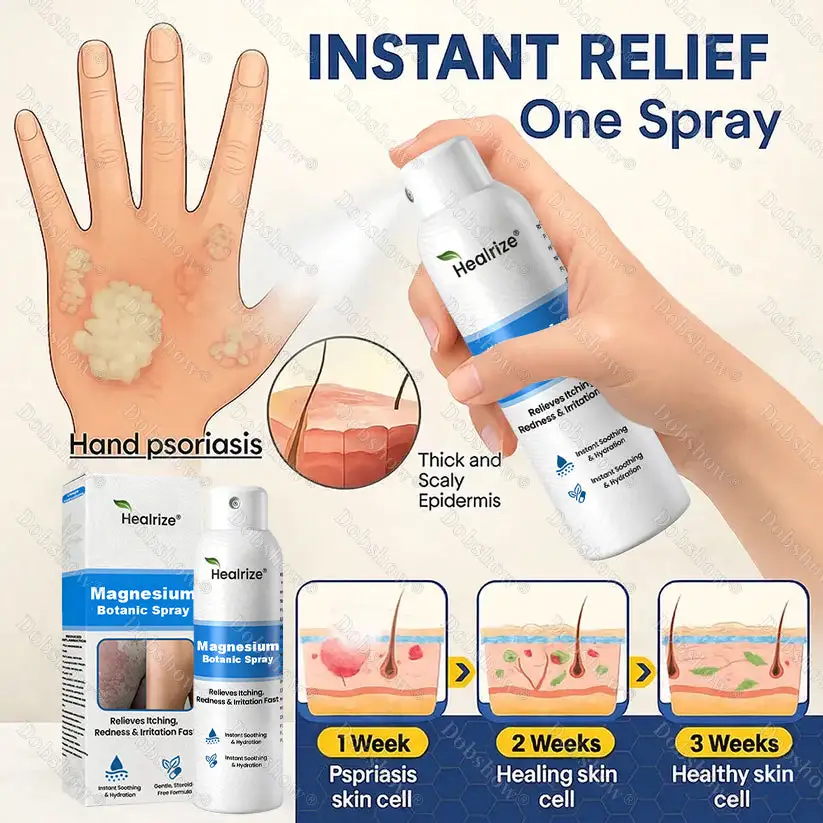 Magnesium Botanic Spray – Advanced Skin Recovery for Psoriasis & Eczema - Image 3