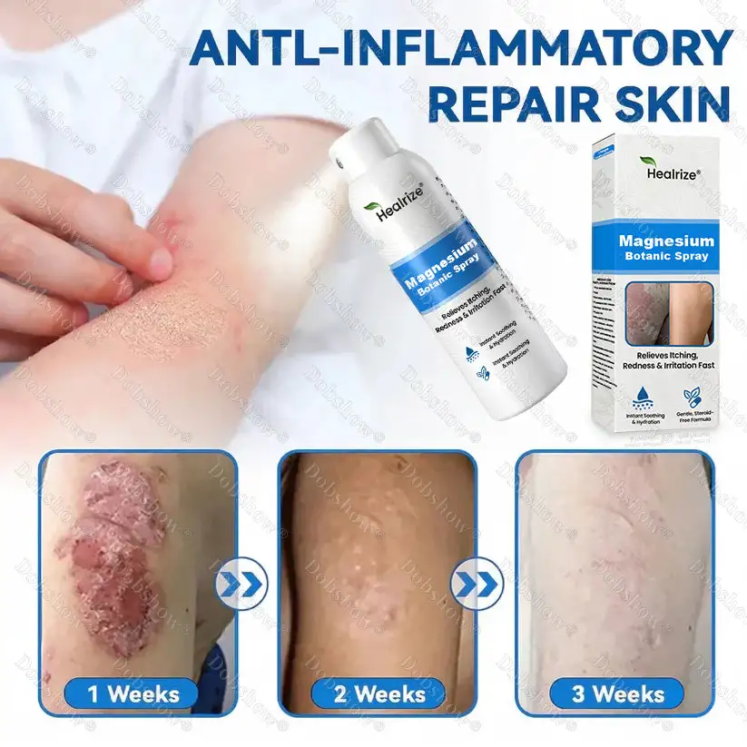 Magnesium Botanic Spray – Advanced Skin Recovery for Psoriasis & Eczema - Image 5