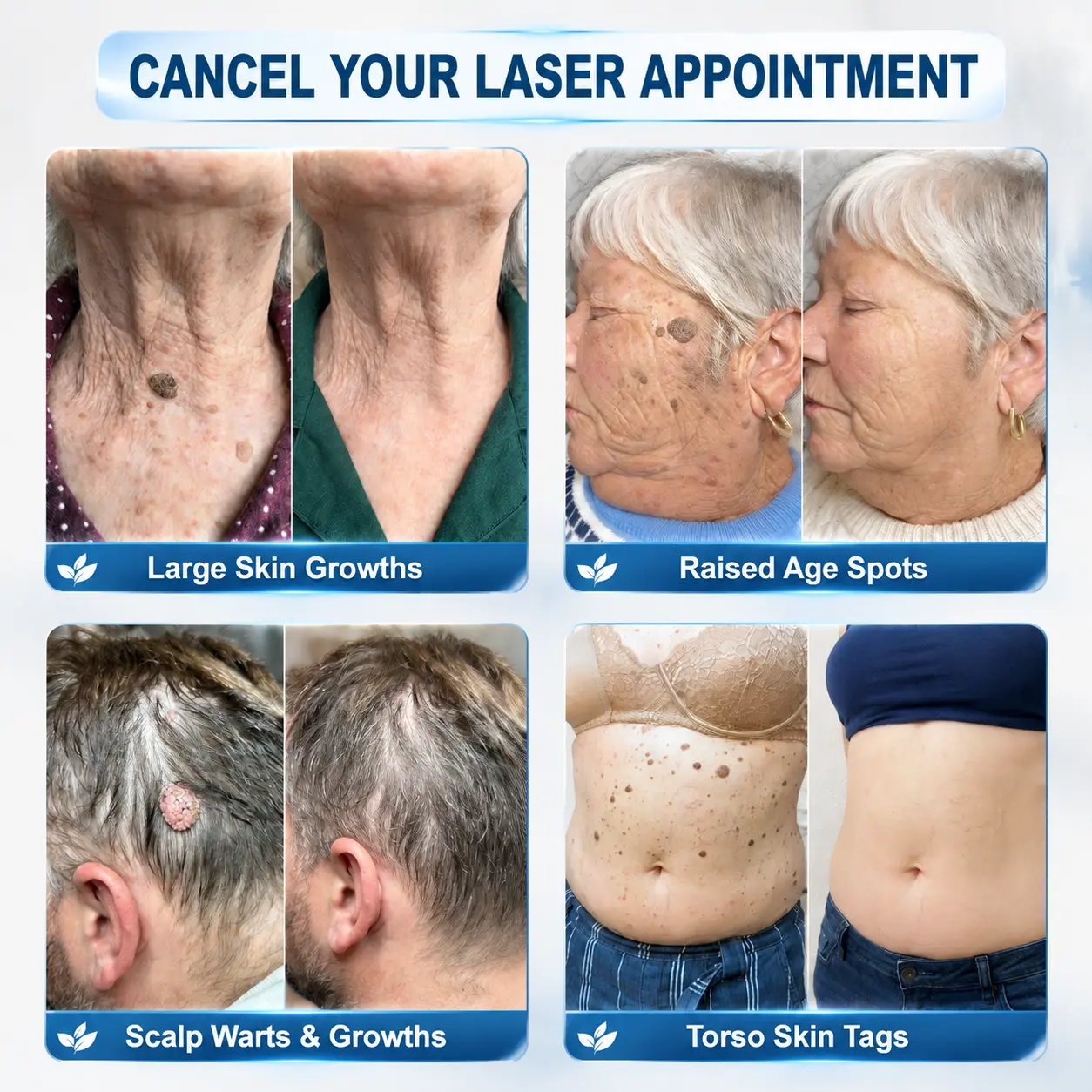 7-Day Skin Renewal Roller - Image 2