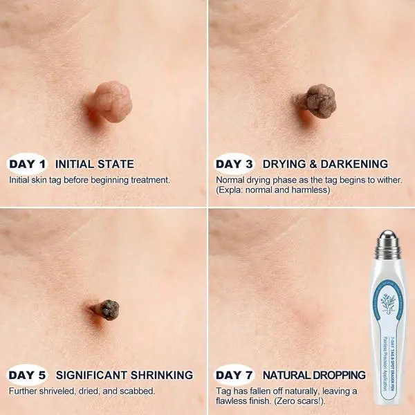 7-Day Skin Renewal Roller - Image 4